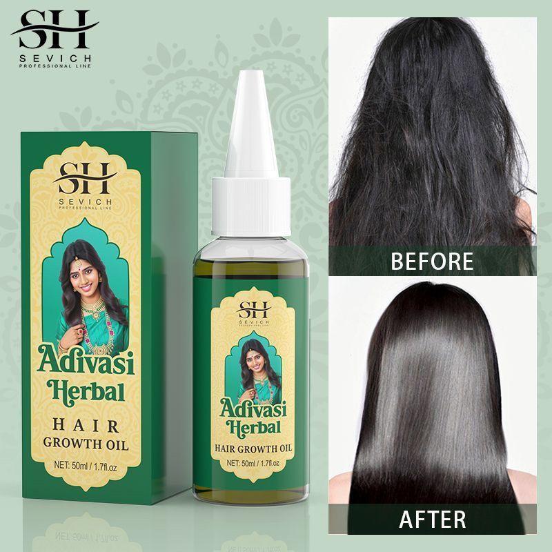 Ayurvedic & Herbal Wellness Kits - زيت أيورفيدا لنمو الشعر من الهند،
