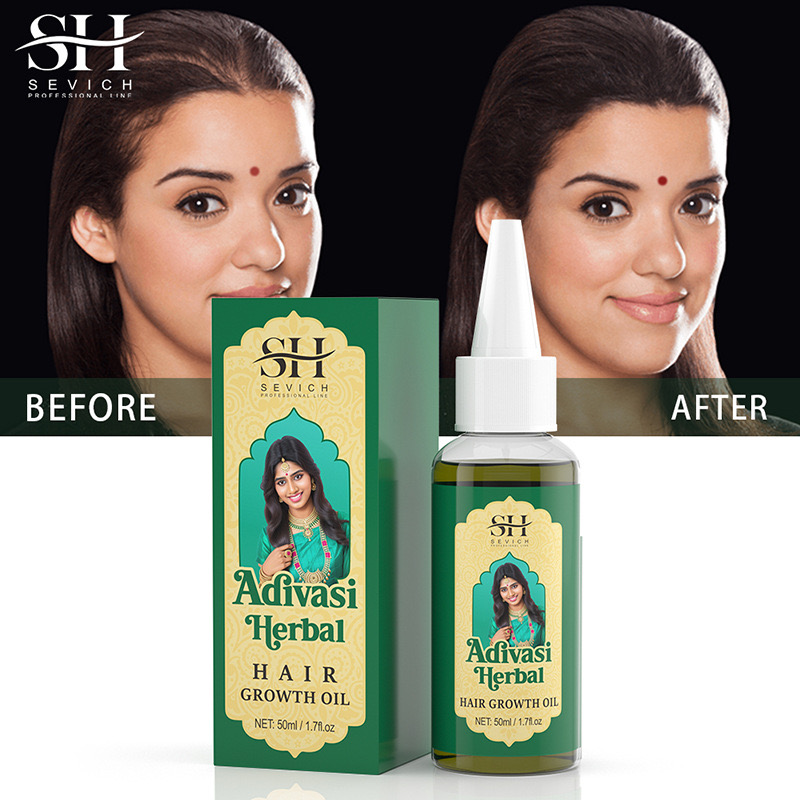 Ayurvedic & Herbal Wellness Kits - زيت عشبي للشعر للرجال ، زيت