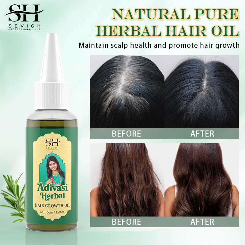 زيت عضوي لنمو الشعر من الايورف - مراجعة Ayurvedic & Herbal Wellness Kits وسعره